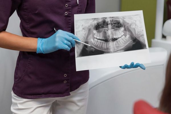 Apa Itu Odontogram? Berikut Penjelasan, Fungsi, dan Juga Manfaatnya